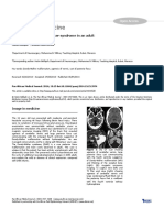 Images in Medicine: Asymptomatic Dandy-Walker Syndrome in An Adult