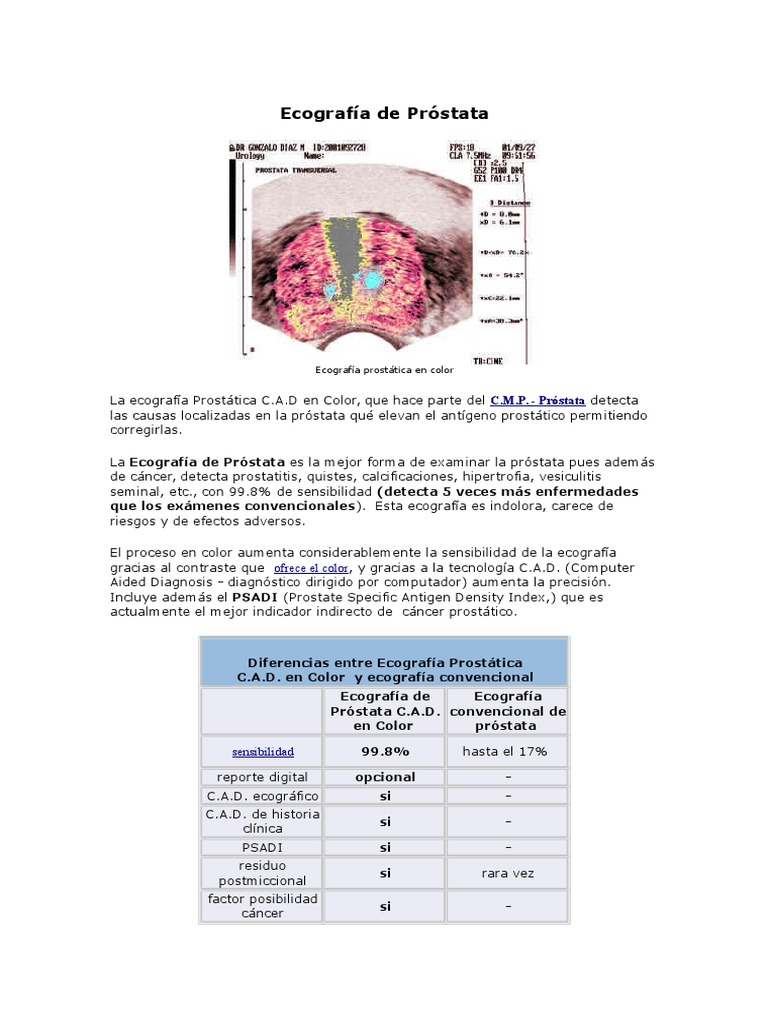 Fogorvostudományi Kar | Tudóstér Prostate adenocarcinoma acinar type