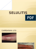 SELULITIS