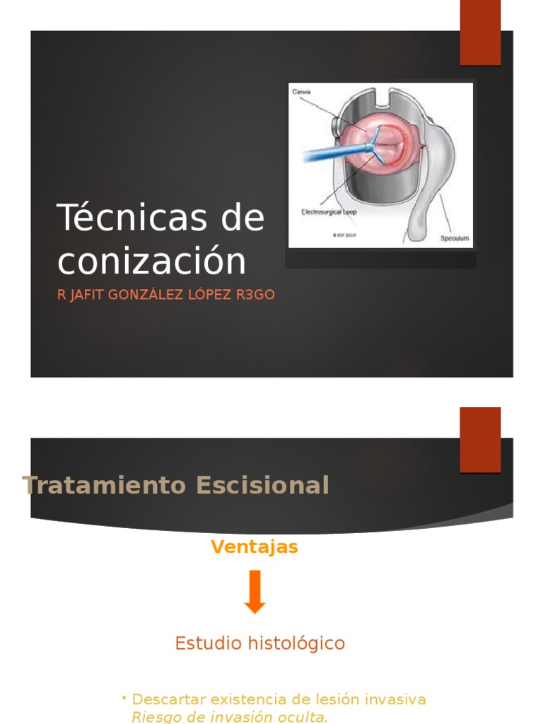 Técnicas de Conización Cervical | PDF | Especialidades Medicas ...
