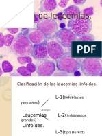 Atlas de Leucemias 