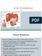 Tumor Pankreas