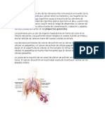 El Cáncer de Pulmón Es Uno de Los Cánceres Más Comunes en El Mundo