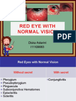 Red Eye With Normal Vision