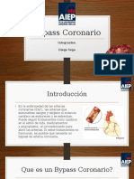 Bypass Coronario: Cirugía para Desbloquear Arterias Cardíacas