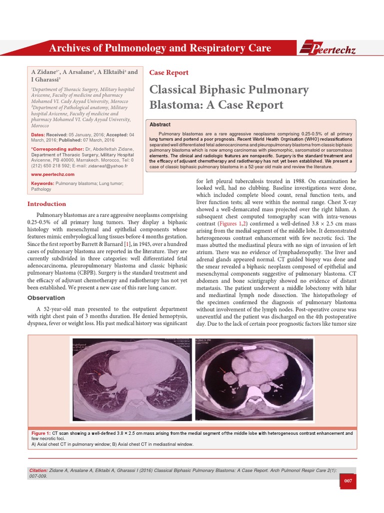 Classical Biphasic Pulmonary Blastoma A Case Report Lung Cancer