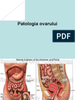 Patologia Ovarului Si Pub