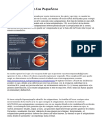 El Astigmatismo en Los Pequeños