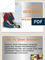 Down Sindrome Ppt