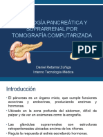 Pancreas SSRR TC