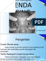 Teknik Pmrik Corpal Fix I