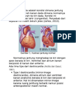 Dextrocardia