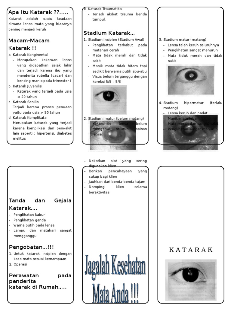 Leaflet Katarak PDF