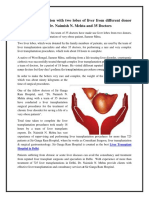 Liver Transplantation With Two Lobes of Liver From Different Donor Was Performed by Dr. Naimish N. Mehta and 35 Doctors