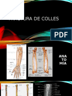 Fractura de Radio Extra Articular, Enfoque Fisioterapeutico