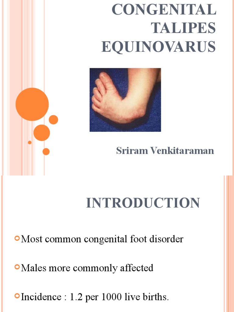 Congenital Talipes Equinovarus Final PDF Foot Skeletal System