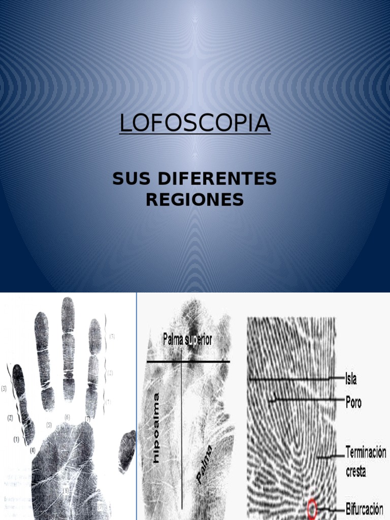 Lofoscopia y Sus Diferentes Regiones | PDF