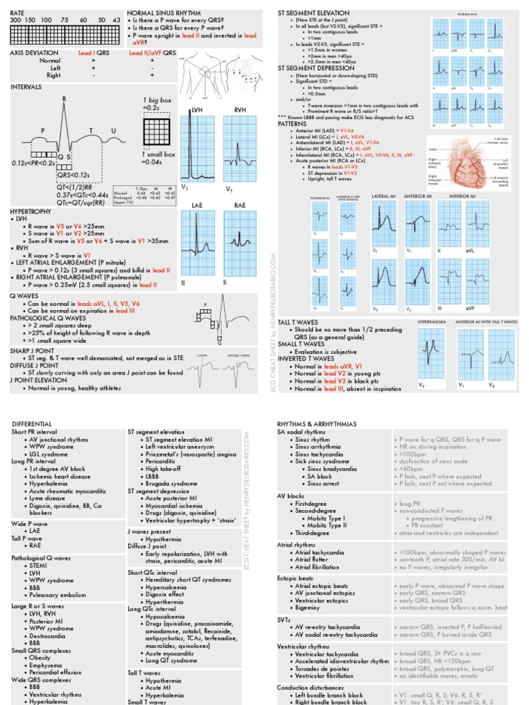 Ecg Cheat Sheet 35 Electrocardiography Cardiac Arrhythmia