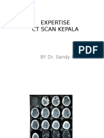 Expertise CT Scan Kepala: BY Dr. Sandy Istanto