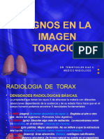 Signos Radiologicos en Torax