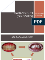 Radang Gusi Nuy