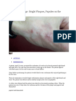 Clinical Challenge Bright Plaques, Papules on the Thumb