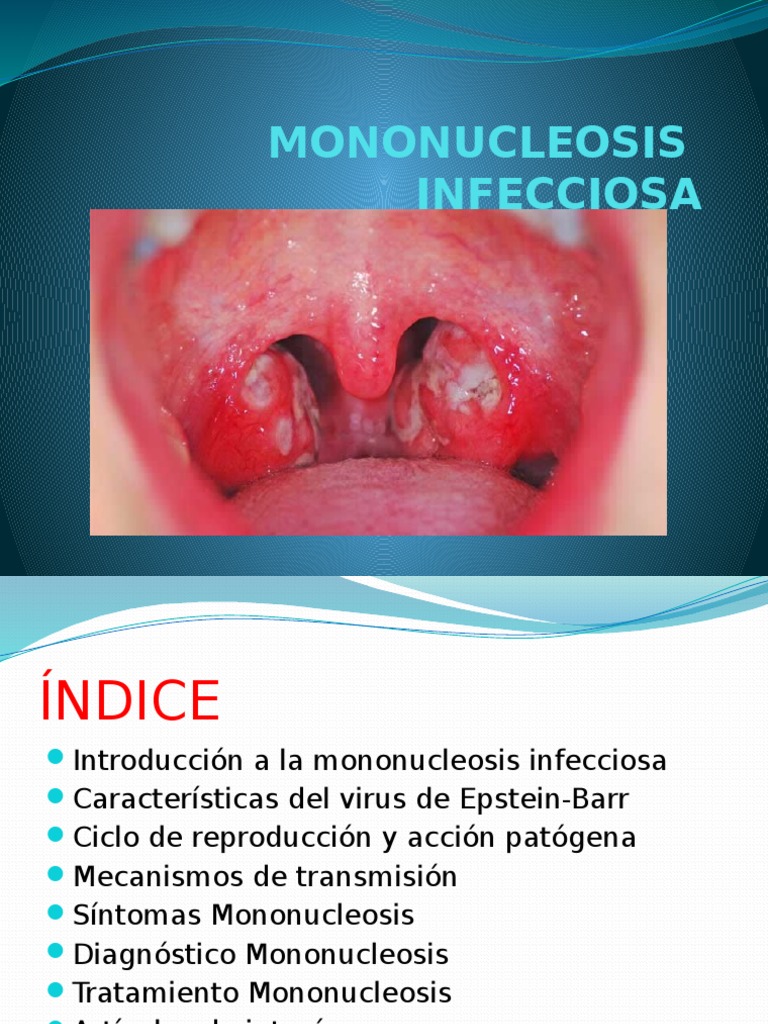 TRABAJO Mononucleosis