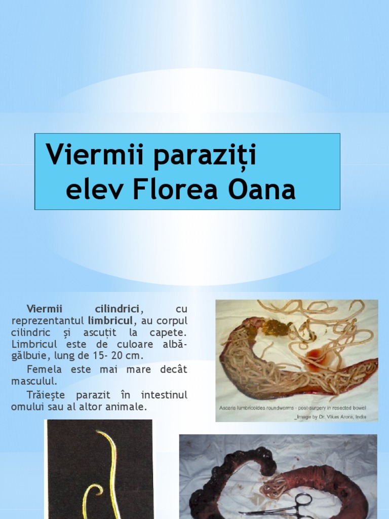 Refer Viermi Powerpoint | PDF