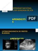 Apendicitis