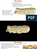 Posterior Review