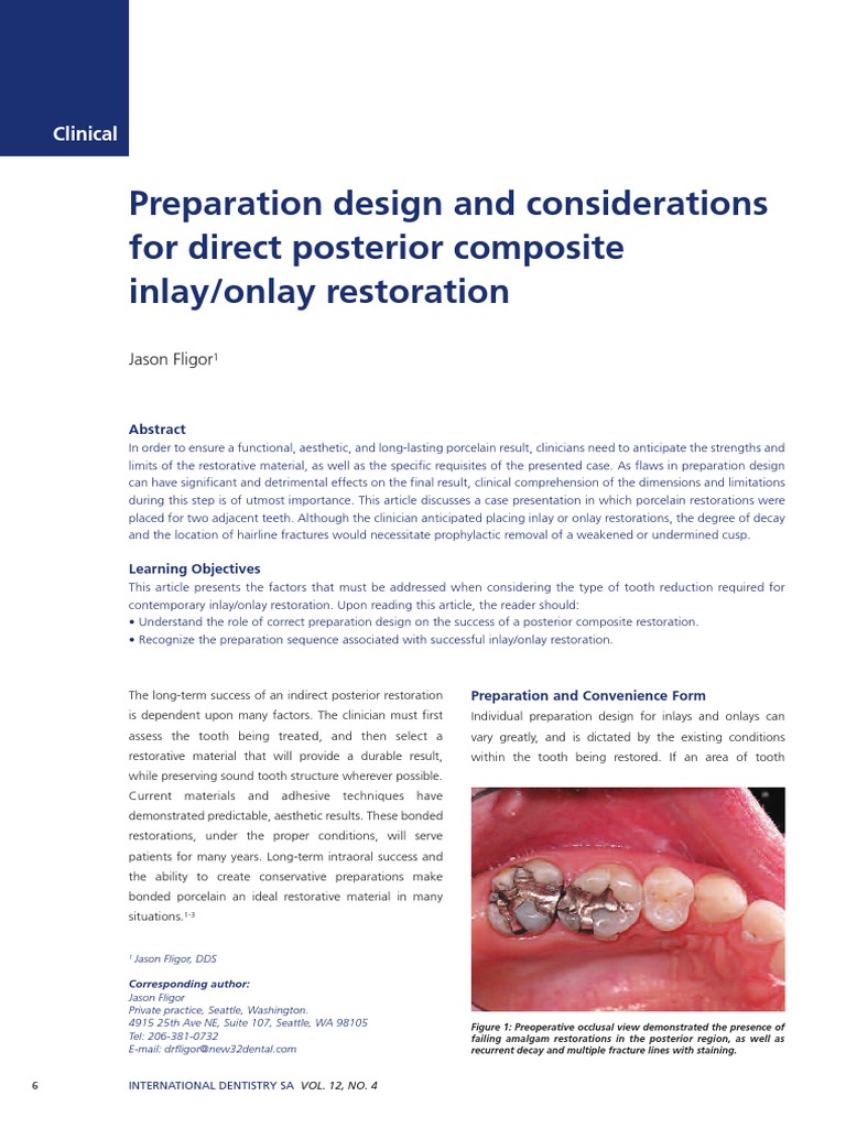 Inlay Preparation Steps , Inlay, Onlay: Indication and Principle of ...