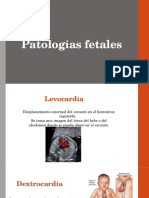 Patologias Fetales3
