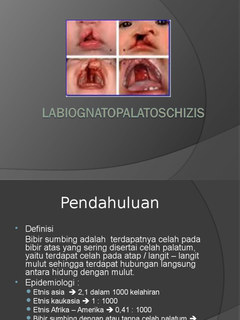 U külotlarini mushukiga solib, tashqariga chiqara olmaydi.