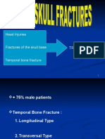 Basal Cranii Fractures