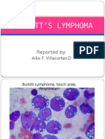 Burkitt S Lymphoma