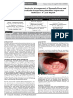 Prosthodontic Management of Severely Resorbed