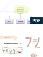 Tipos y DX de Neuropatía