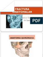 Fractura Orbitomalar