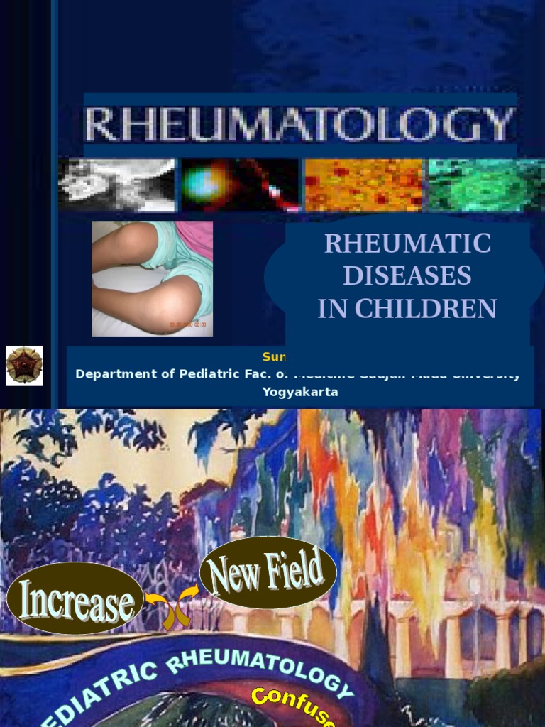 Rheumatic Diseases in Children: Department of Pediatric Fac. of ...