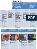 Queratitis