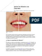 Cómo Blanquear Los Dientes Con Productos Naturales