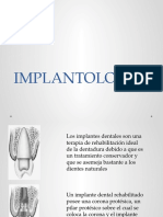 4- IMPLANTOLOGÍA