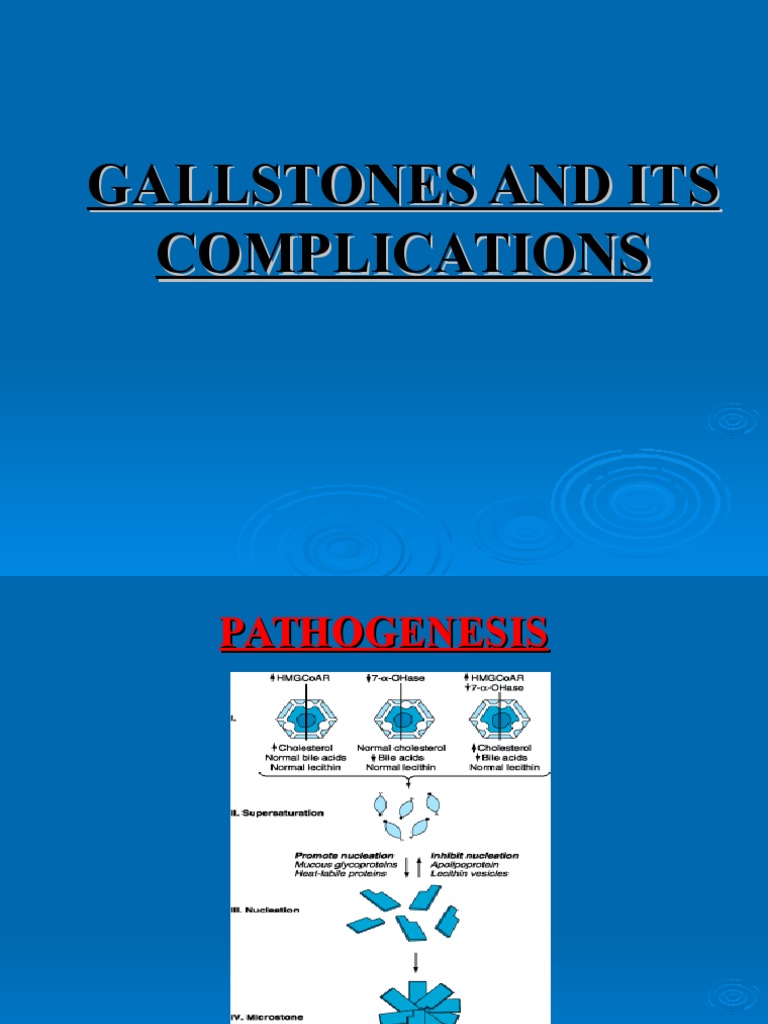 Galls Stones Diseases And Disorders Organ (Anatomy) Free 30day