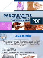 278064571 Pancreatitis Sdxs