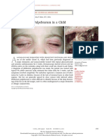 Phthiriasis Palpebrarum in A Child: Images in Clinical Medicine