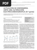 INTERPRETACION ELECTROCARDIOGRAFICA IV