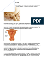 Depilación Y Olor Vaginal.