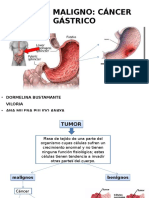 Tumor Maligno Terminado Final Final