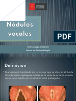 Nódulos Vocales