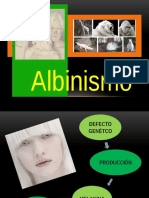 Albinismo